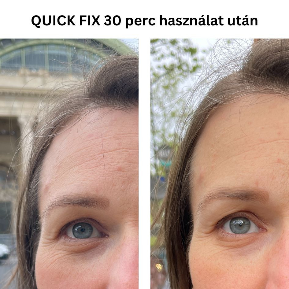 QUICK FIX szemkörnyékápoló azonnali b.o.t.o.x hatású peptiddel 15ml
